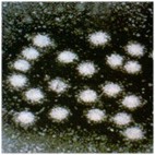 Hepatitis A