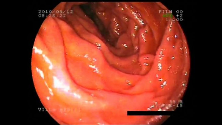 Duodenum