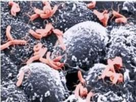 Helicobakter Pylori